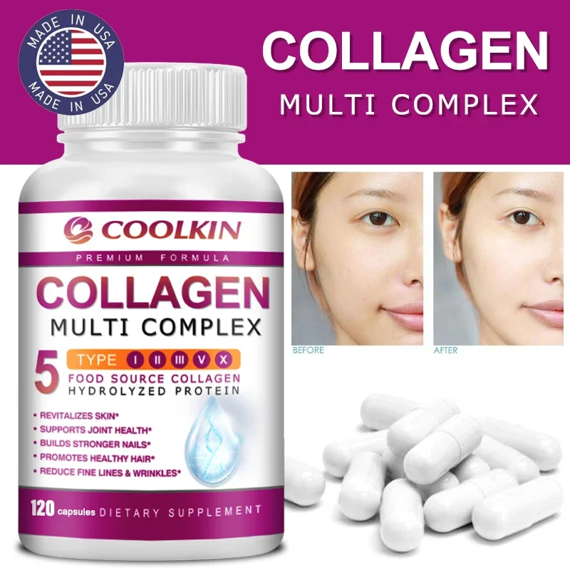 Coffee X - Collagen Multi Complex - ประเภท I,