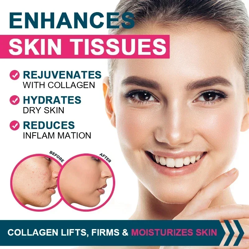 Multiple Collagen - ผิว ข้อต่อ - Coffee X บทวิจารณ์และราคา